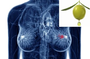 aceituna cancer de mama